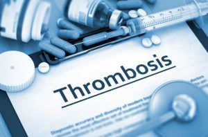 thrombosis on paper