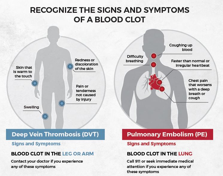 Signs and Symptoms of Blood Clots
