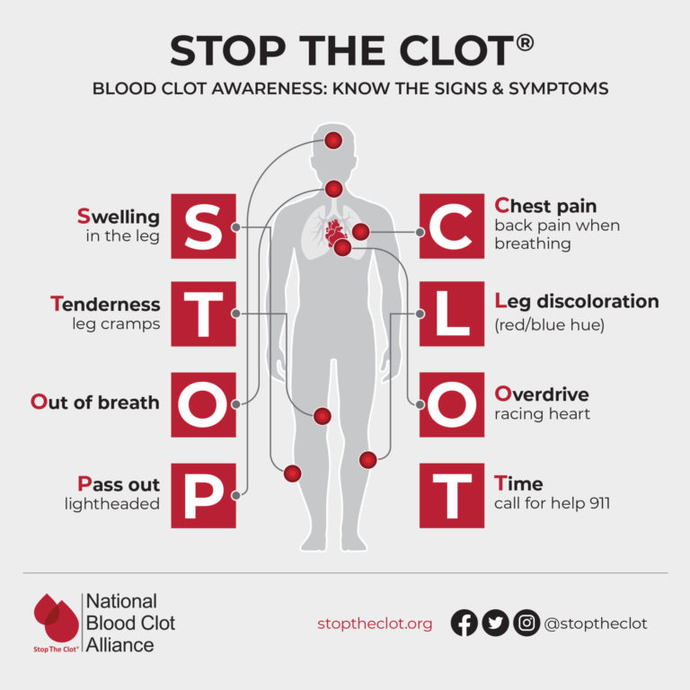 Blood Clot Info Risks, Symptoms, and Prevention